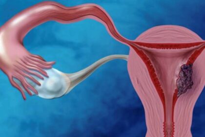 UOC Ginecologia Oncologica, AOSP Bologna | Cancro dell’endometrio: network epigenetici come nuovi biomarcatori di prognosi e terapia. Verso una medicina personalizzata